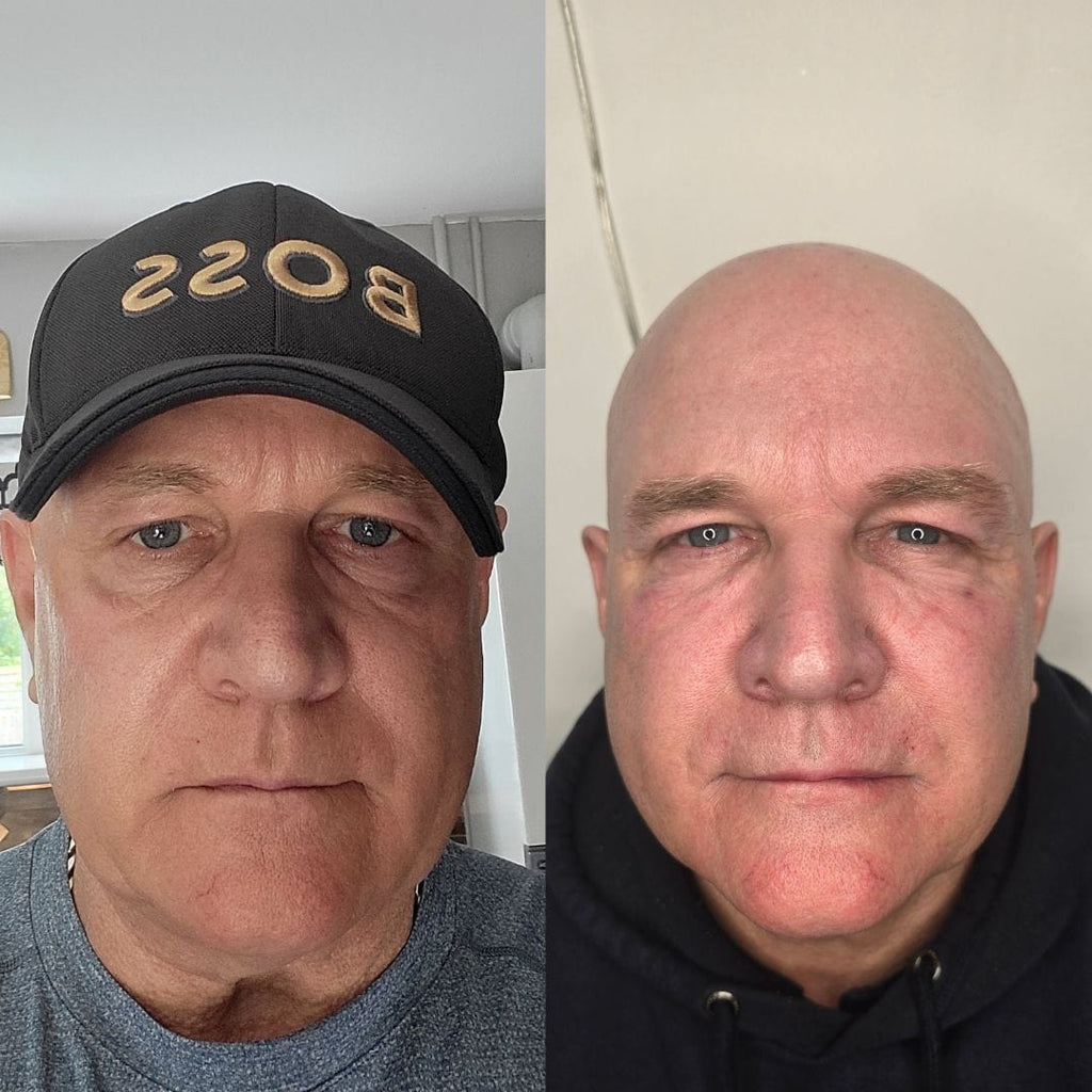 LUXIA Exosomes Skin+ 1 x 5ml - man showing before and after use on skin