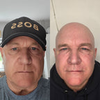 LUXIA Exosomes Skin+ 1 x 5ml - man showing before and after use on skin