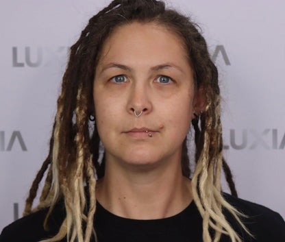 LUXIA Fat Dissolver 5 x 10ml image of woman after using fat dissolver on face